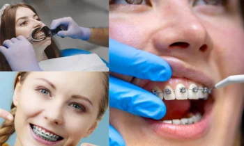 Düzce Ortodonti Doktorları ile Sağlıklı ve Estetik Gülüşler