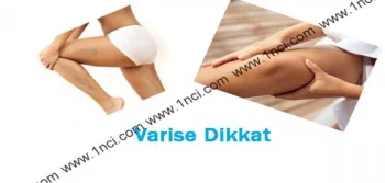 Varise Dikkat